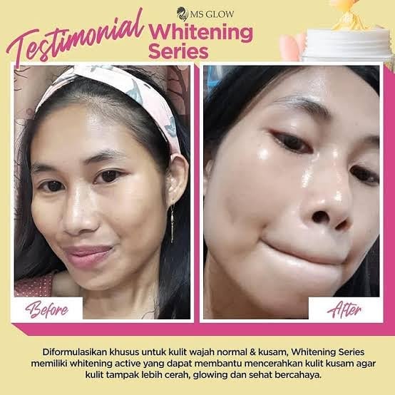 Ms Glow Paket Whitening Perawatan Wajah Kusam Dan Berminyak Perawatan Alami Untuk Wajah Kusam Cepat-4