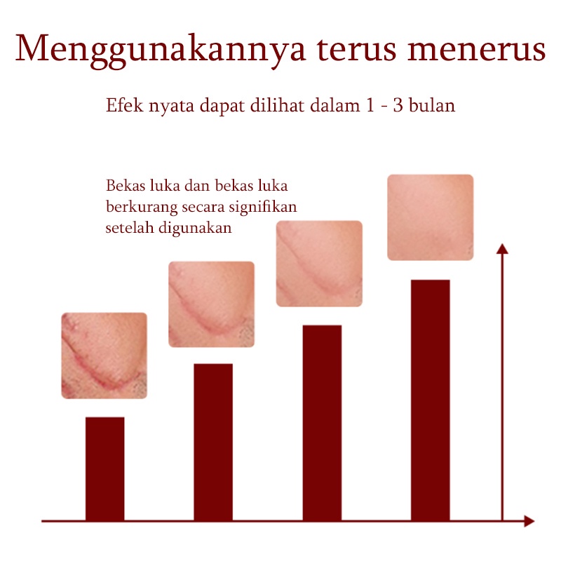 Krim Cream Salep penghilang luka bekas Menghilangkan stretch mark Penghilang bekas luka yang ampuh Memperbaiki bekas luka bakar Bekas Jerawat Bekas luka lama Benjolan dan jerawat 50G