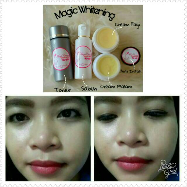 Magic Whitening dr. Rani