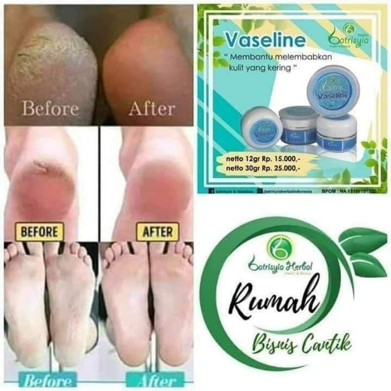 ( BISA COD ) VASELINE UNTUK KAKI PECAH PECAH/ CREAM TUMIT AMPUH/ CREAM KAKI PECAH PECAH