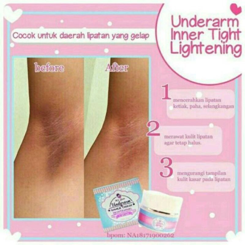 UNDERARM MS GLOW - CREAM PEMUTIH KETIAK DAN BAGIAN LIPATAN