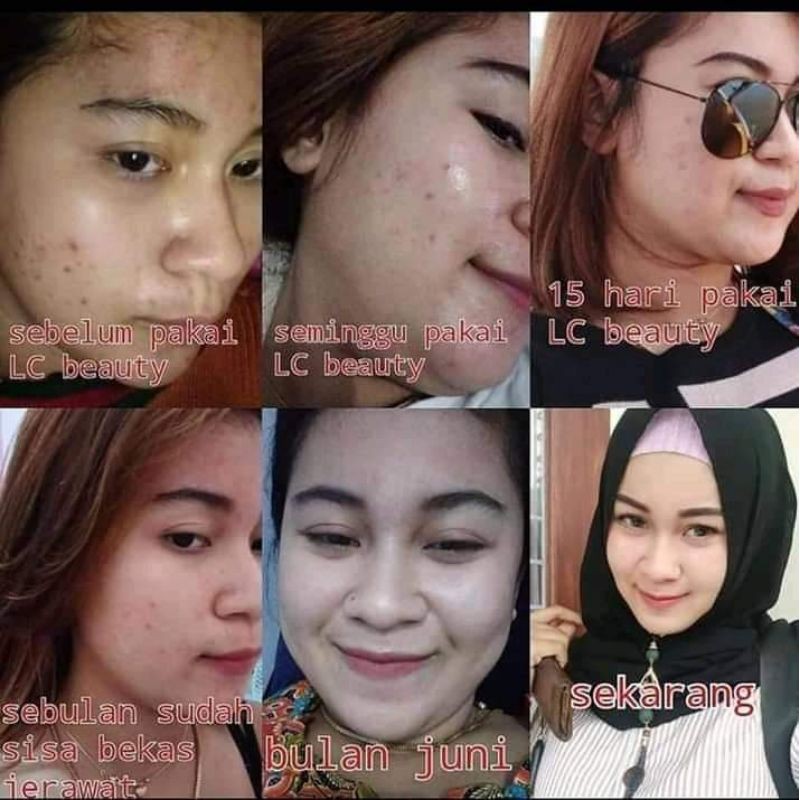 ELCY BEAUTY BPOM | NEW PACKAGING LC BEAUTY 100% ORIGINAL| KEMASAN BARU LC | KF SKIN | LUXURY SKINCARE PEMUTIH AMPUH PALING BEST SELLER