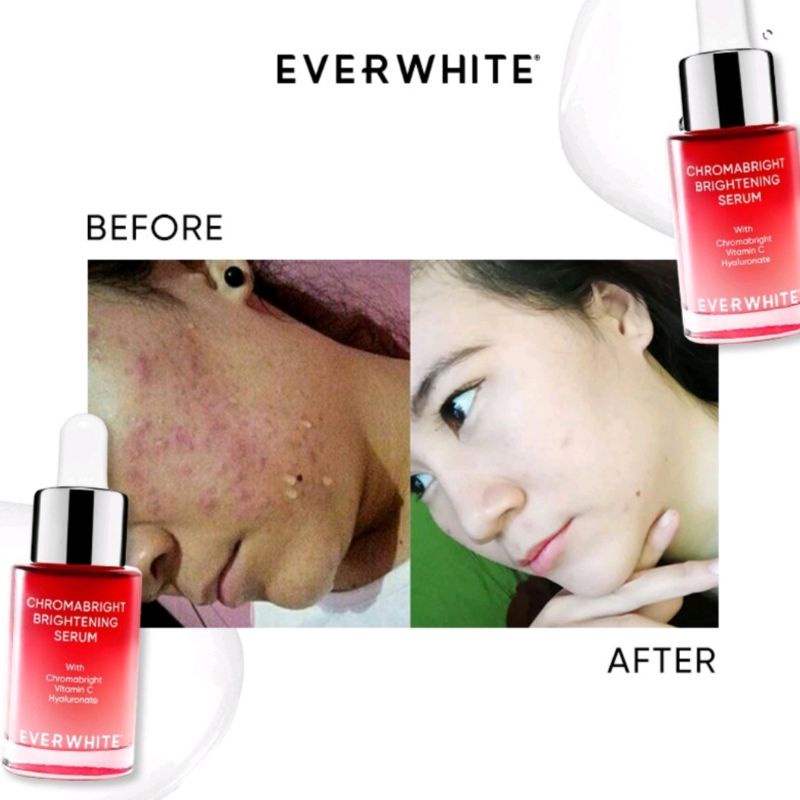 C Everwhite Brightening Essence Serum (Mencerahkan) - ChromaBright 15ml