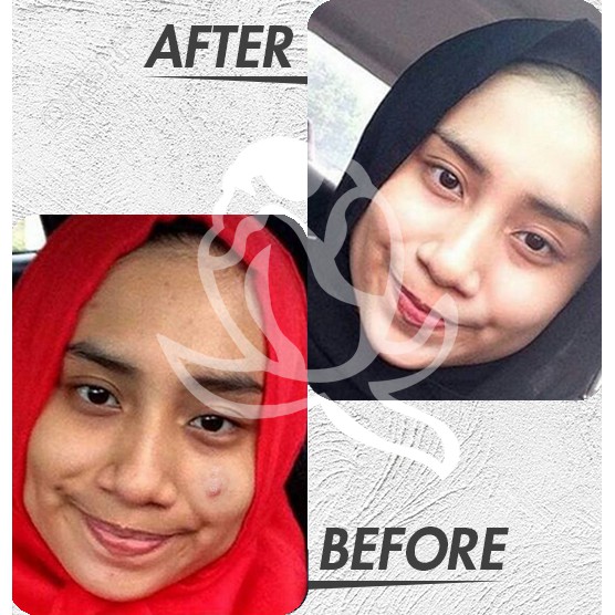 Mellydia Paket Basic A Perawatan Wajah Alami Di Rumah Agar Putih Bersih Skincare Step 1-4
