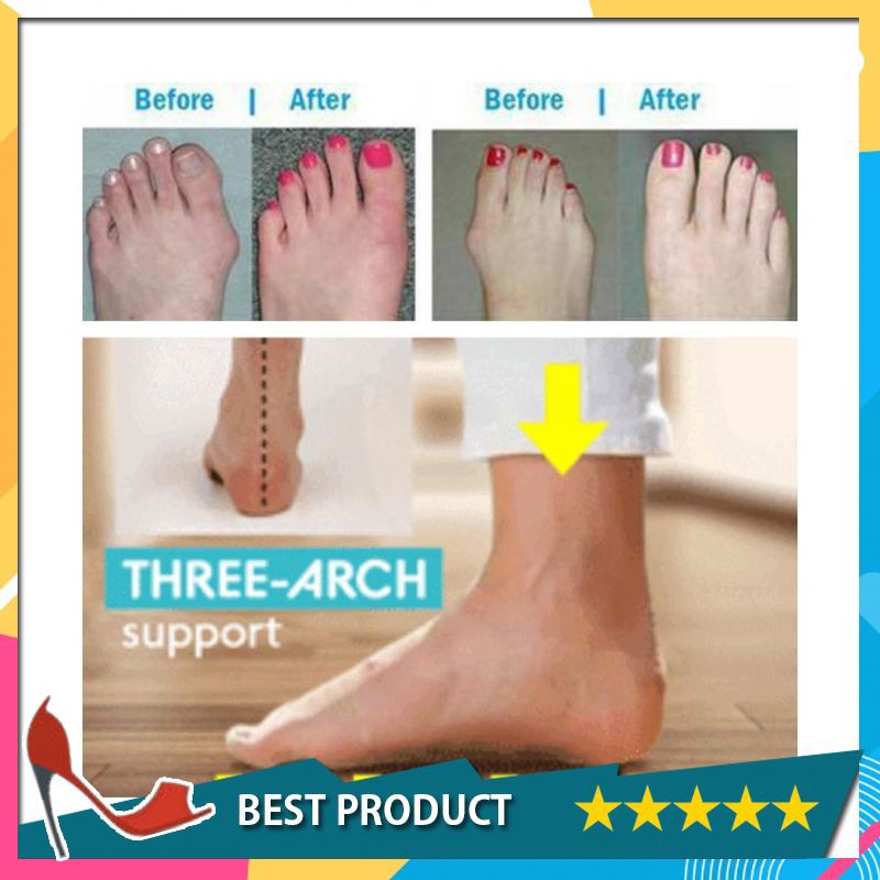 arch support bunion shoes
