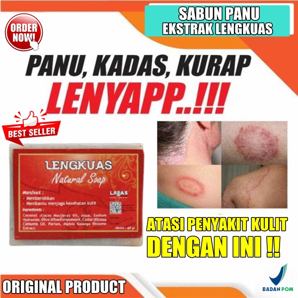 sabun untuk panu jamur kulit paling ampuh 100% ori lengkuas sabun anti panu natural soap BPOM