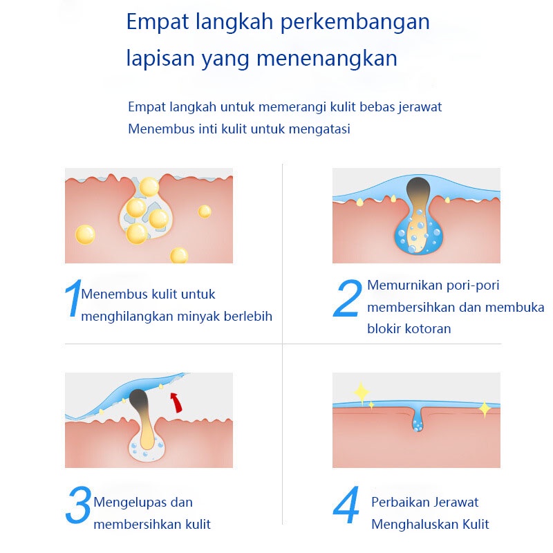 obat totol jerawat totol jerawat salep jerawat 100g esensi herbal menghilangkan jerawat  memperbaiki kulit dalam memperbaiki bekas jerawat