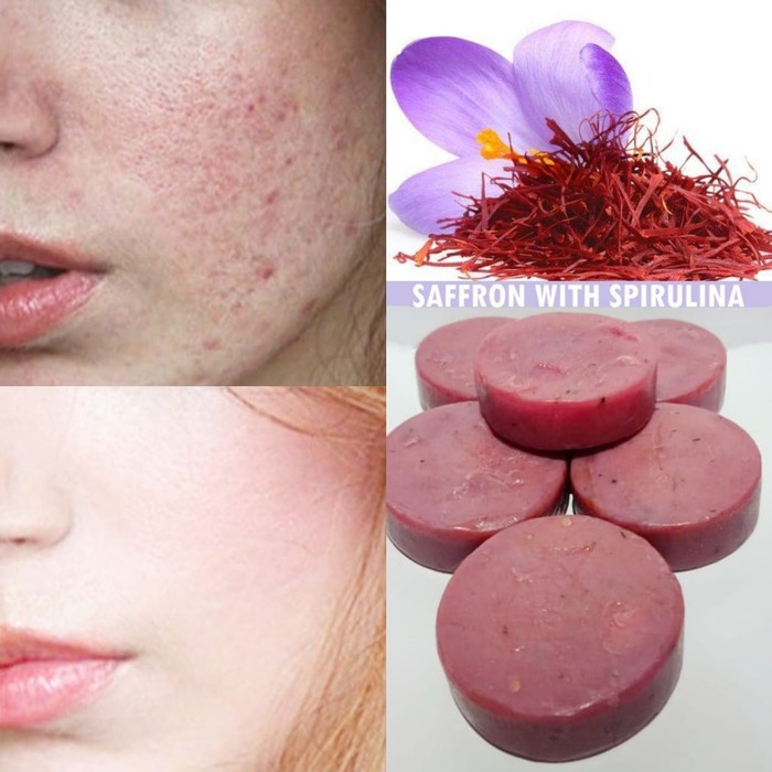 Sabun Saffron ALEYA ORIGINAL sabun jerawat flek hitam pemutih wajah bikin glowing 100% ORI Dijamin