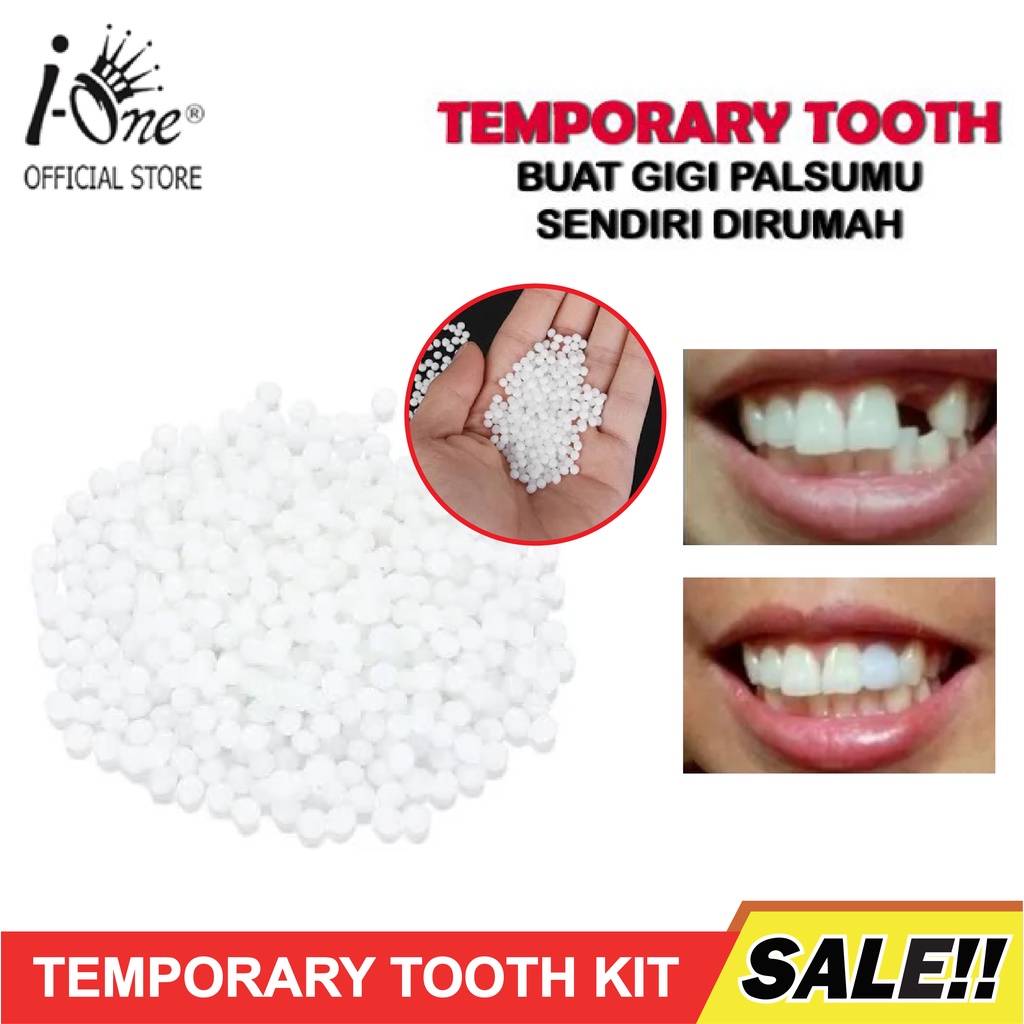 GIGI PALSU BUAT SENDIRI / TEMPTOOTH  PENAMBAL GIGI OMPONG PATAH RENGGANG