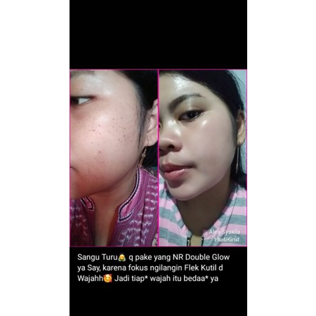 NR GLOW SKINCARE PAKET GLOW ll REMAJA BUMIL BUSUI DAN KULIT SENSITIF