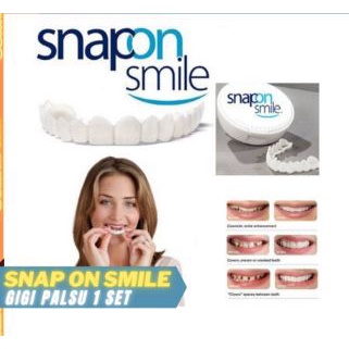 Snap On Smile 1 Set // Gigi Palsu Silikon Atas Bawah // 1 Set Veneer Gigi palsu