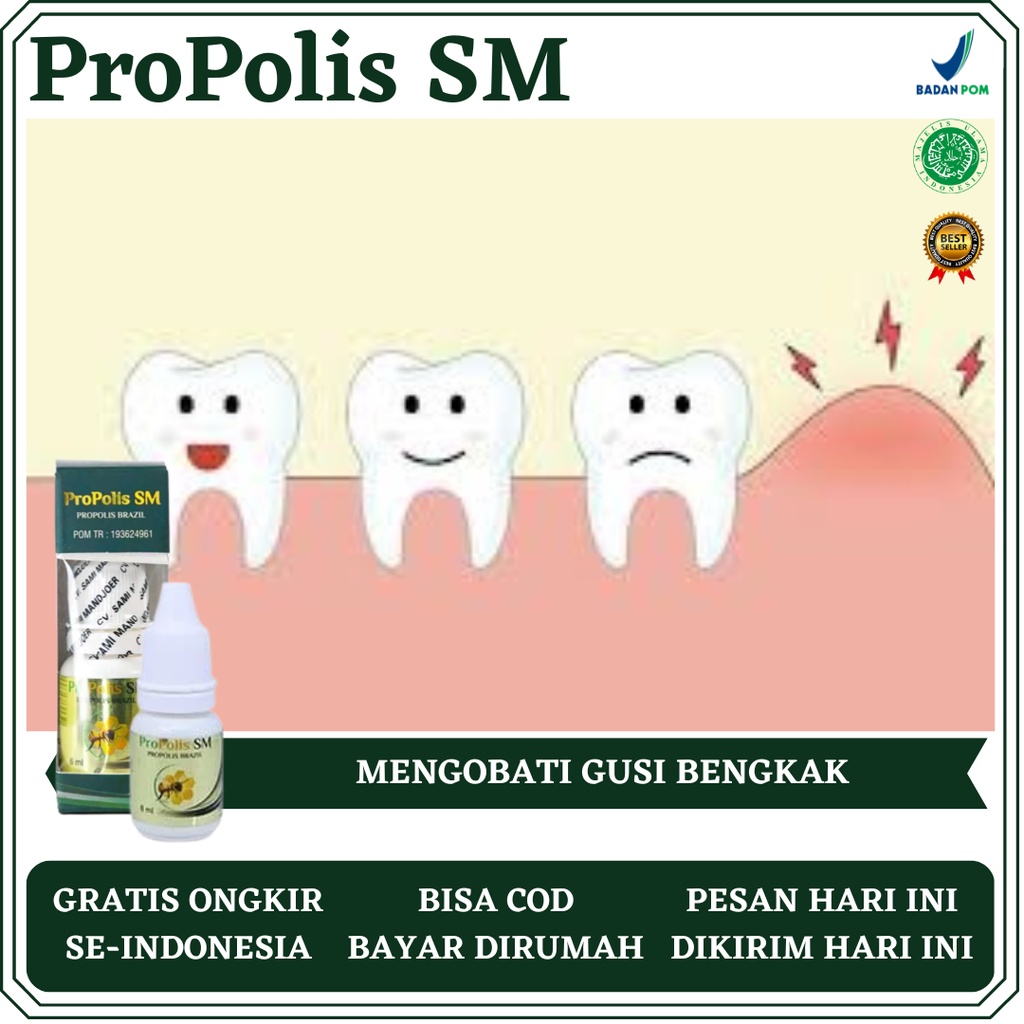 Obat Gusi Bengkak, Obat Gusi Bernanah, Obat Radang Gusi, Obat Sakit Gusi, Obat Abses Gusi, Obat Infe