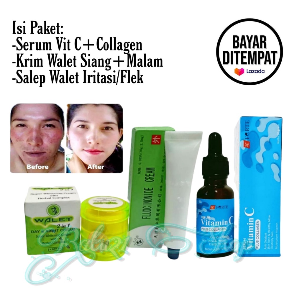 Paket 3in1 Skincare Walet Herbal/Krim Wajah Siang Malam+Salep Perawatan Flek Hitam Dan Penghilang Je