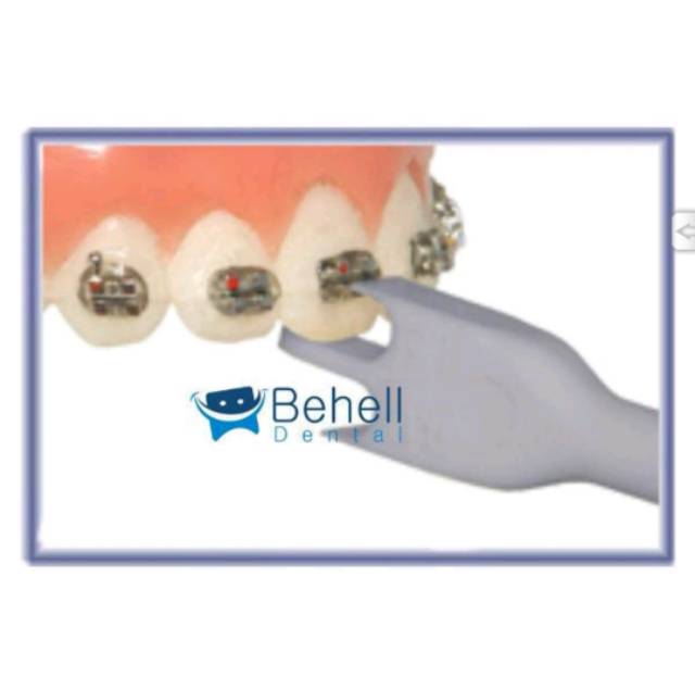 Bracket Height Gauge Orthodontic / Bracket Position / Alat Pengukur Bracket