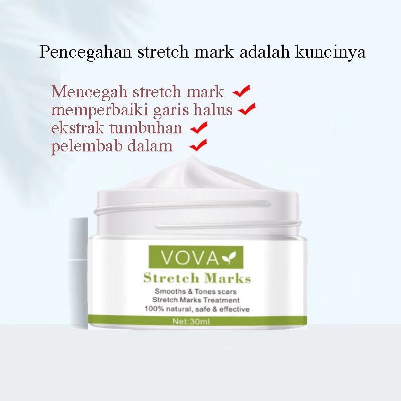 Krim Kehamilan StretchMark 30ml Cream krim bekas luka Pengencang Kulit Solusi Perut Gatal dan Anti Stretchmark Ibu Hamil StretchMark Krim Penghilang Stretch Mark mama choice stretch mark