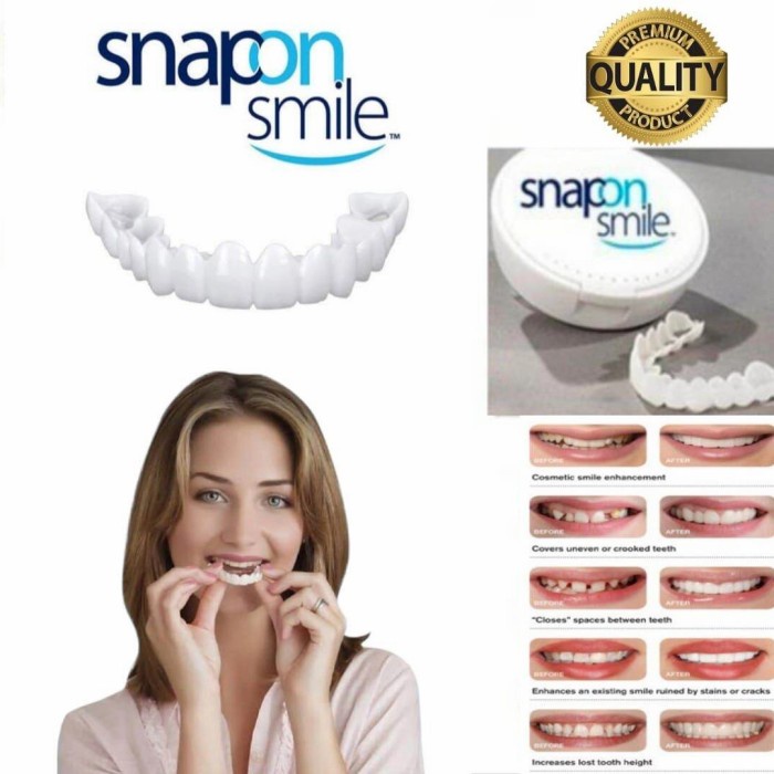 Snap On Smile Veneers 100% Original