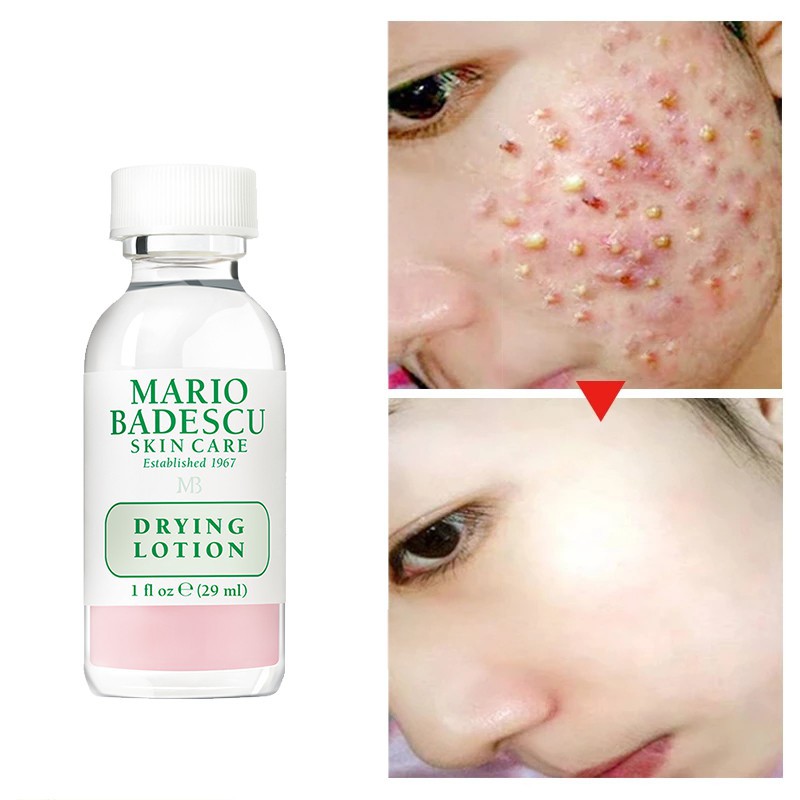 MARIO BADESCU DRYING LOTION Acne Jerawat 29ML ori