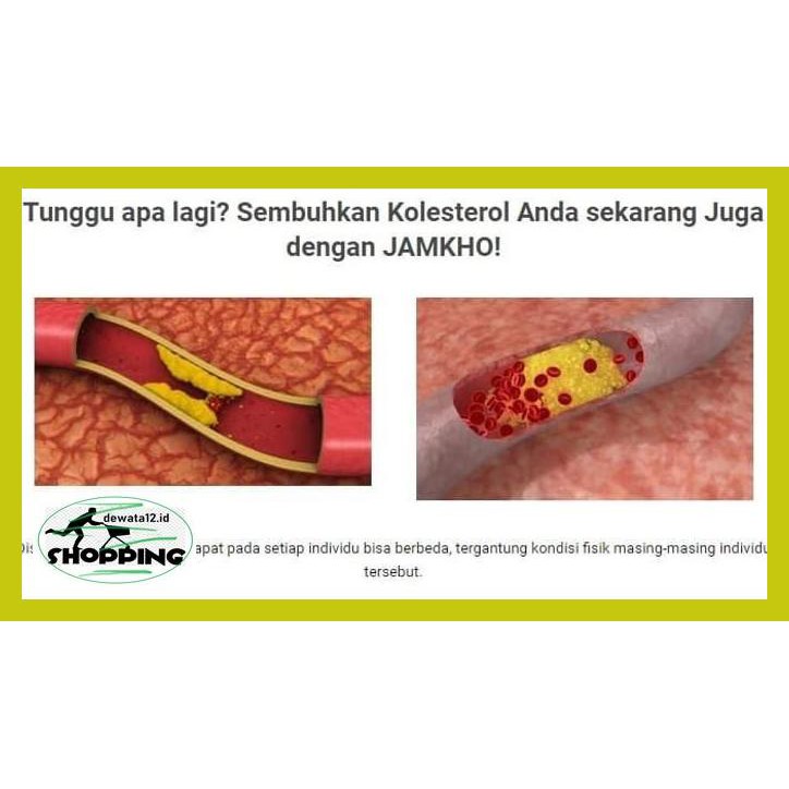 

Obat Herbal- Obat Herbal Jamkho 100 Ml Turunkan Kolesterol 6Eruio46-