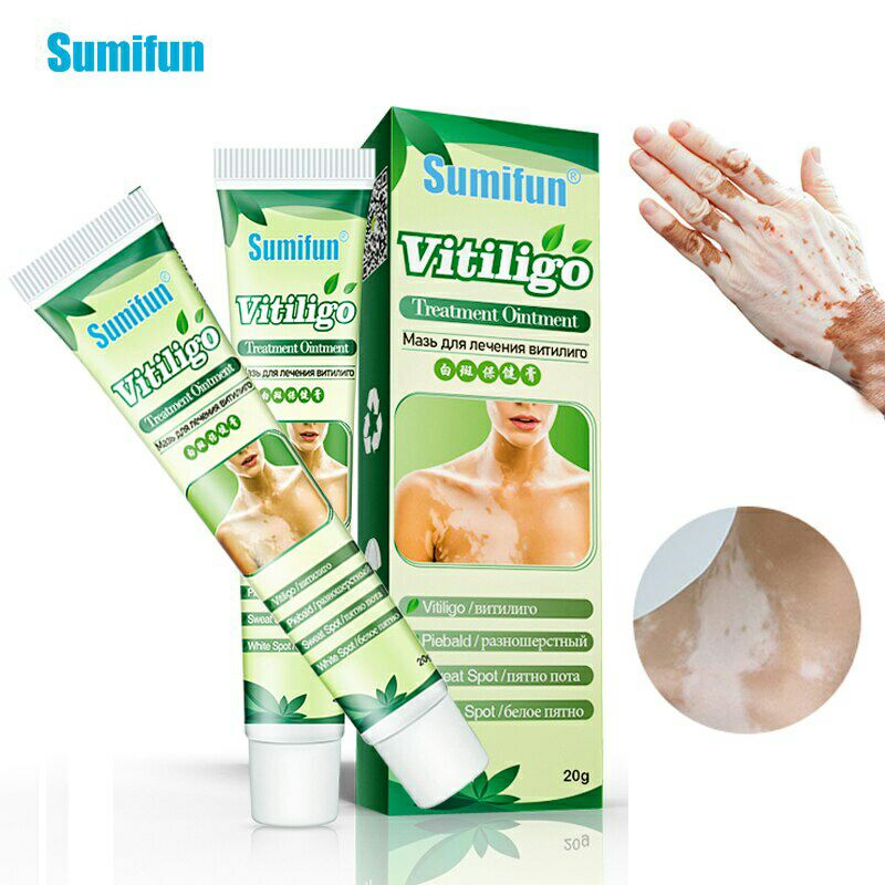 Sumifun Cream Salep Vitiligo Antibakteri