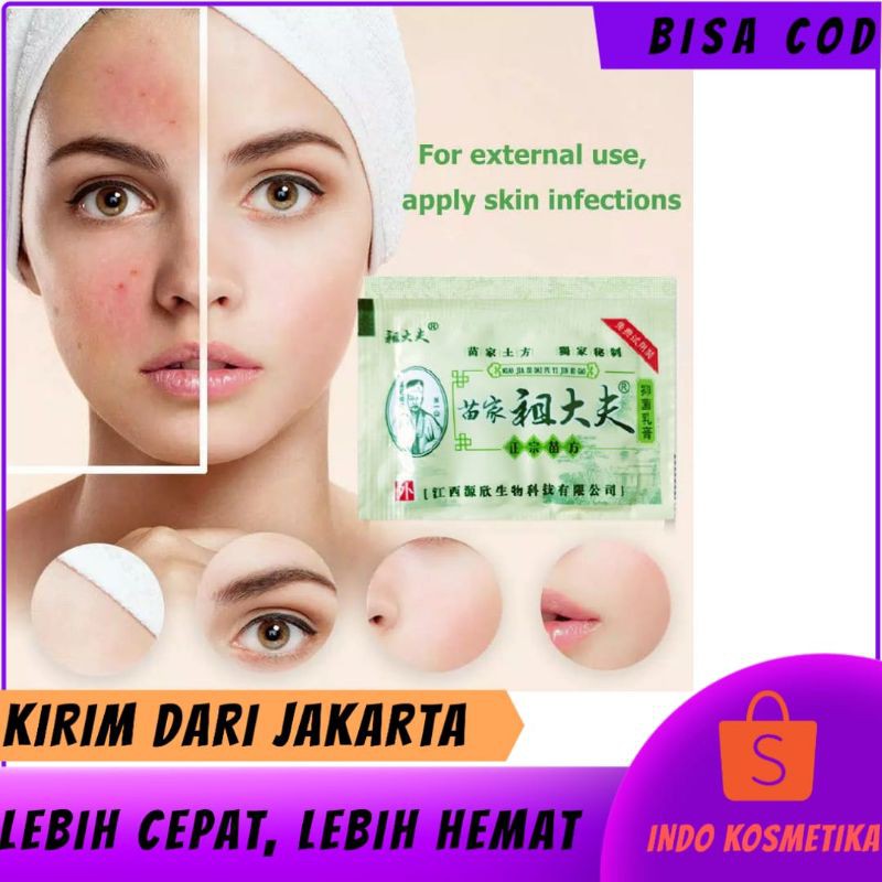 (SASET) ZUDAIFU SALEP GATAL ALERGI KULIT SELANGKANGAN EKSIM JAMUR OBAT HERBAL CINA PALING AMPUH