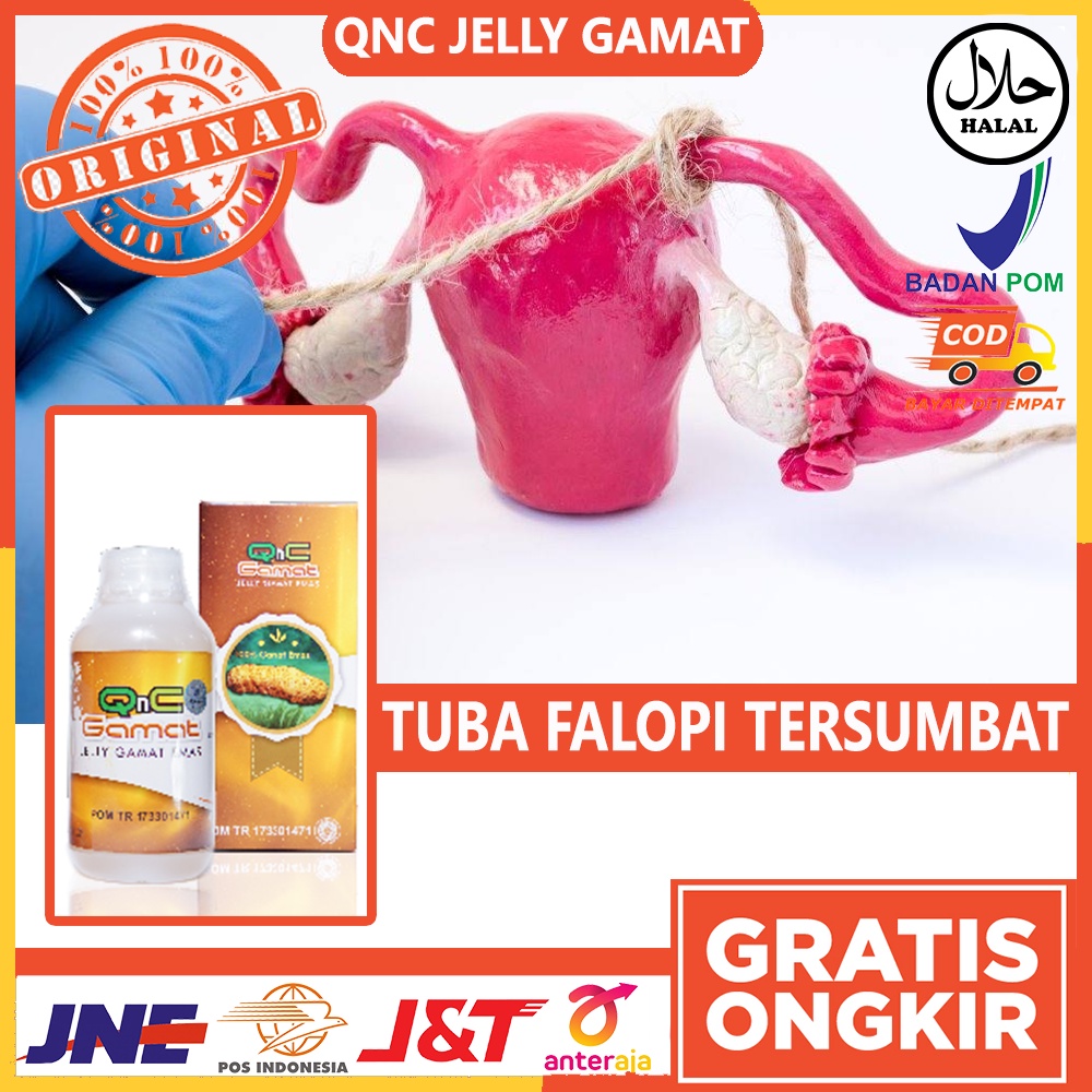 Obat Tuba Falopi Tersumbat - Penyumbatan Tuba Falopi - Indung Telur Tersumbat - Kewanitaan Tersumbat