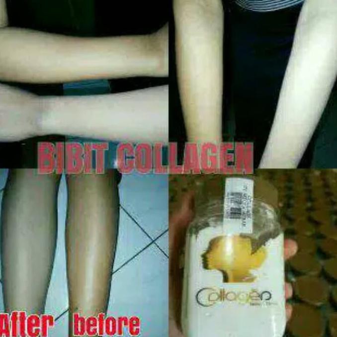Perawatan Kulit/ Bibit Collagen ( Bitcoll ) - Bibit Kolagen - Bibit Colagen Asli Cv Sh