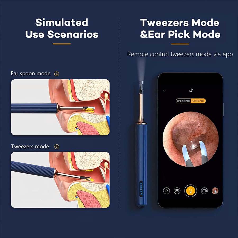 Bebird Pembersih Telinga Note 3 Pro Smart Camera Korek Kuping