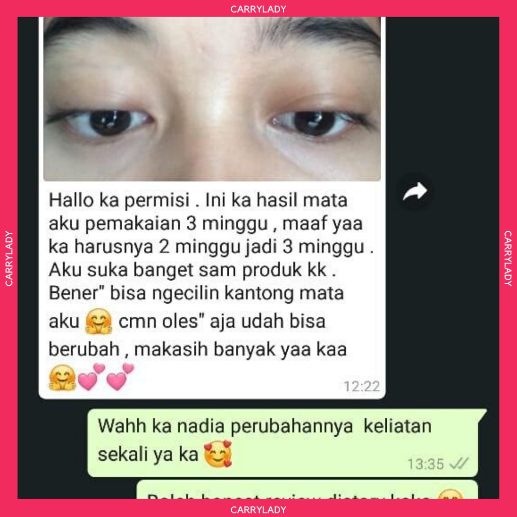 CREAM DKM MASKER MATA EYE SERUM KRIM MATA PENGHILANG MATA PANDA EYESERUM PENGHILANG KERUTAN