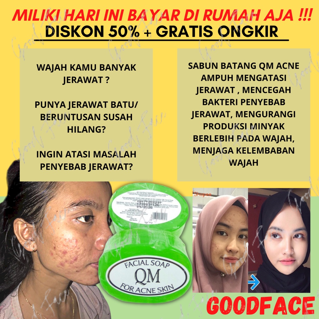 QM FACIAL SOAP FOR ACNE SKIN ORIGINAL BPOM SABUN QM BPOM