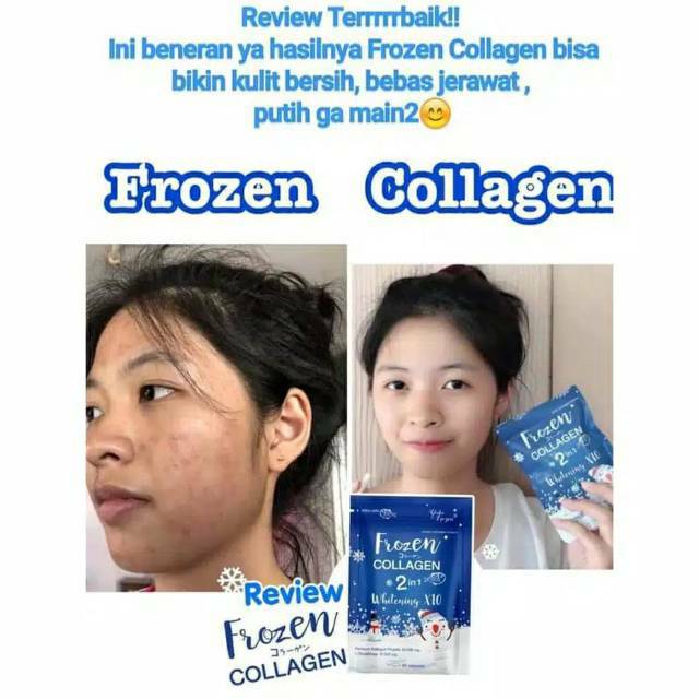 FROZEN COLLAGEN Gluta 2in1 Whitening / ASLI Pemutih Kulit Frozen Collagen 100% ORIGINAL THAILAND