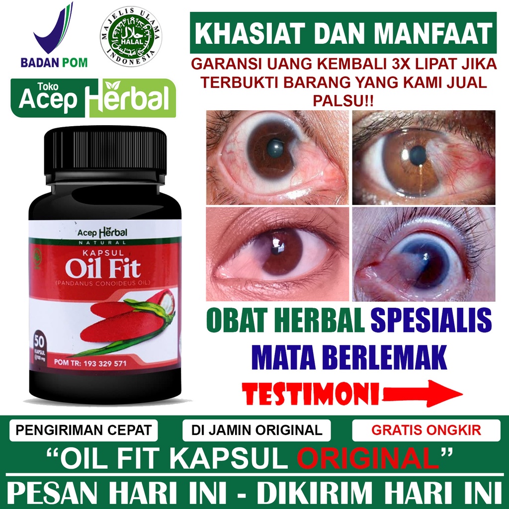 OILFIT PALING ORIGINAL - Obat Mata Berlemak Aman BPOM - Mata Berlemak Kekuningan, Berselaput, Pterig