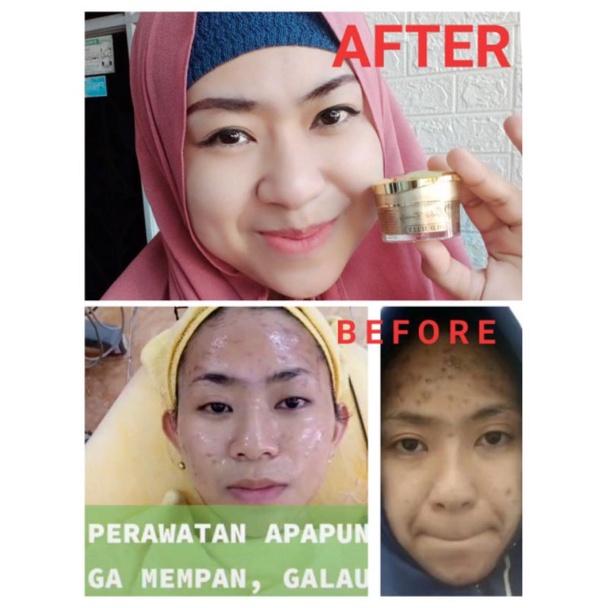 GOLD JELLY KEDAS BEAUTY BPOM GLOWING SEHAT