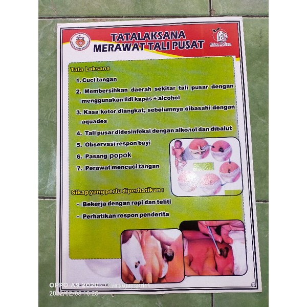 

(37)POSTER TATALAKSANA MERAWAT TALI PUSAT