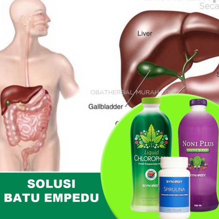 {cantikstore} Paket Herbal Obati Batu Empedu Plus Suplemen Kekebalan Tubuh Dewasa Diskon