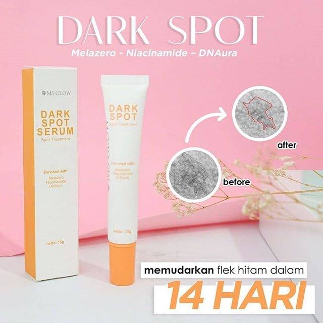 Dark spot serum ms glow