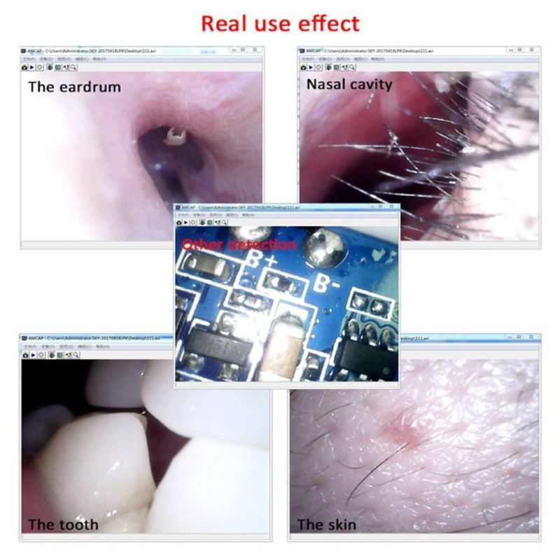 Pembersih Telinga Kamera - Ear Cleaning Endoscope USB Camera Korek Kuping Kamera Endoscope