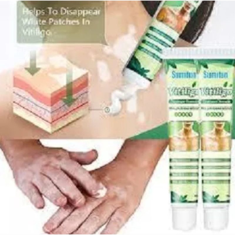 SUMIFUN VITILIGO OBAT PENGHILANG BERCAK PUTIH HERBAL AMPUH MENGHILANGKAN PIGMENT PUTIH  MERATAKAN WARNA KULIT-20gr