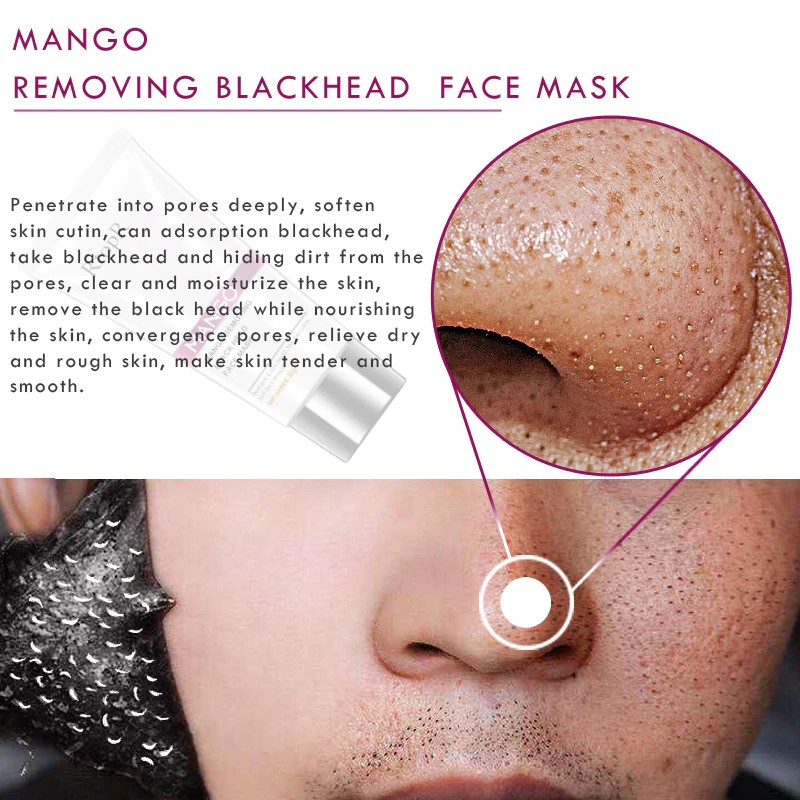 Mango Blackhead Remover Acne Treatment Nose Oil Control Mud Pore Strip Mask Whitening Shopee Indonesia
