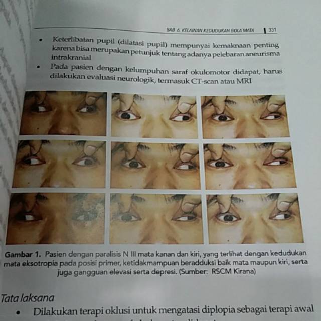 ( ORIGINAL ) BUKU AJAR OFTALMOLOGI EDISI 1 FKUI Th.2020