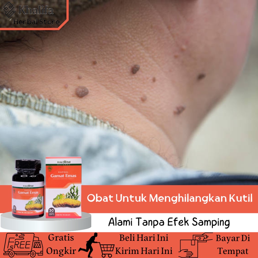 Obat Merontokan Kutil, Obat Perontok Kutil, Obat Untuk Menghilangkan Kutil, Obat Herbal Untuk Menghi