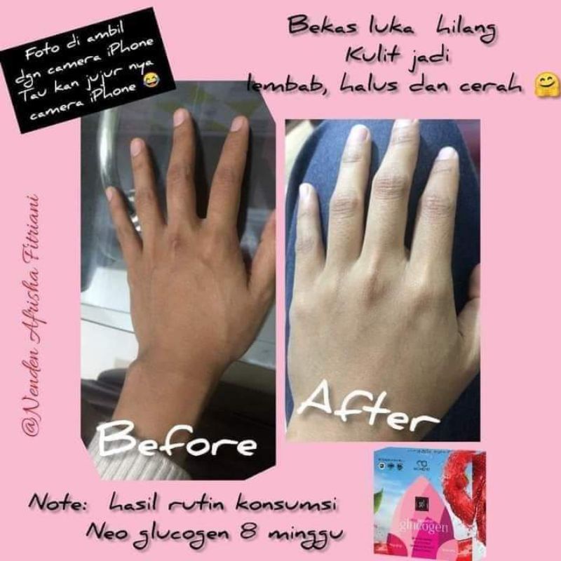 Neo Glucogen Box Mini