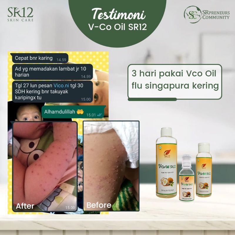 VCO Oil SR12 100% Minyak Kelapa Murni Tanpa Bahan Kimia - VICO Cold Press Suplemen Kesehatan dan Kecantikan Kulit