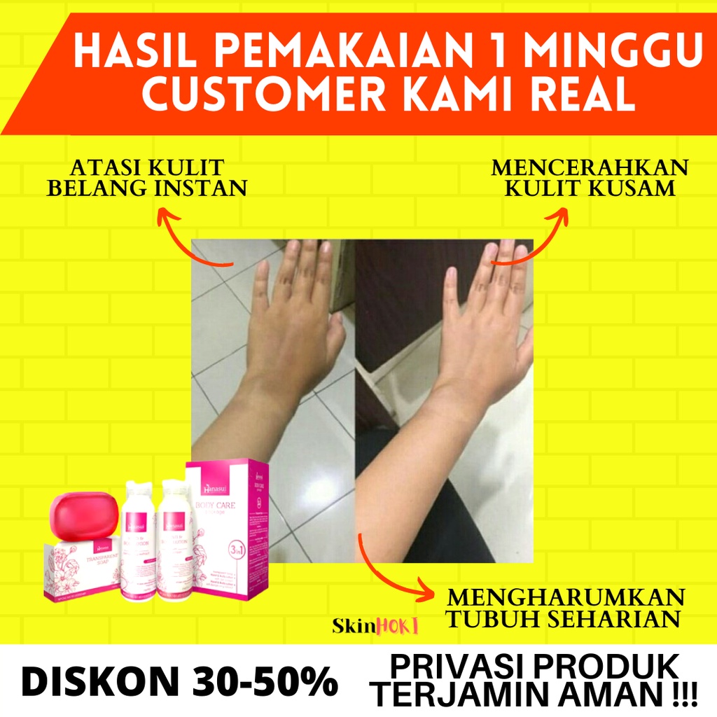 PEMUTIH BADAN PENYAMAR FLEK HITAM PAKET HN BODYCARE HANASUI NEW 3IN1 LOTION PEMUTIH PENGHILANG BEKAS LUKA ORIGINAL BPOM