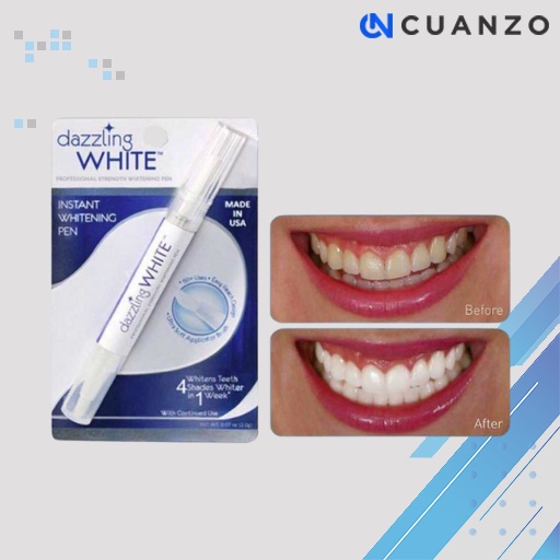 Dazzling White Pemutih Gigi Teeth Whitening Essence Serum / Serum Pemutih Gigi Lampu LED Viral Tiktok /Pemutih Gigi Kuning dan Bau Mulut Permanen / Alat Perontok Karang Gigi / Pembersih Plak Gigi Efektif / Alat Pemutih Gigi Elektrik Murah Original