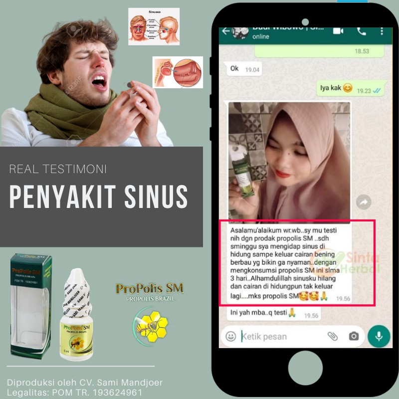 Obat Hidung Gatal dan Sering Bersin Akibat Rhinitis Alergi Alami, Mata Gatal Berair, Pengenti Meler-6