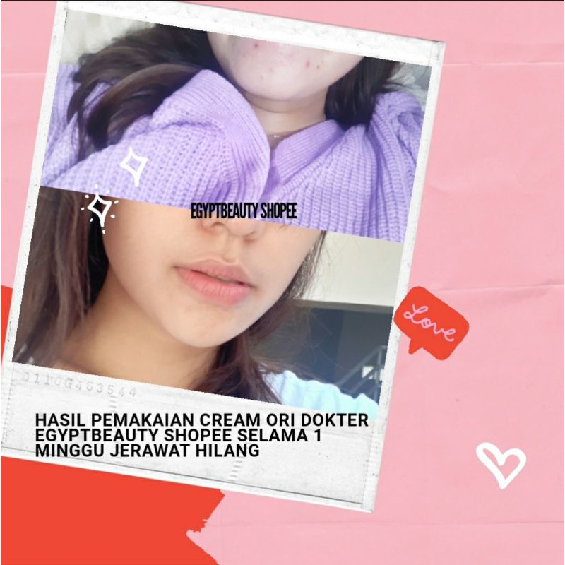 CREAM KOJIC WHITENING KRIM MALAM KOJIC