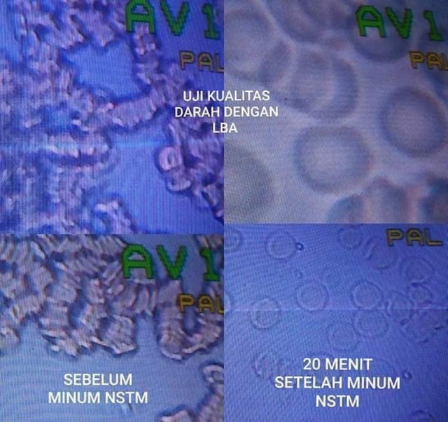 

NSTM penambah Imun tubuh