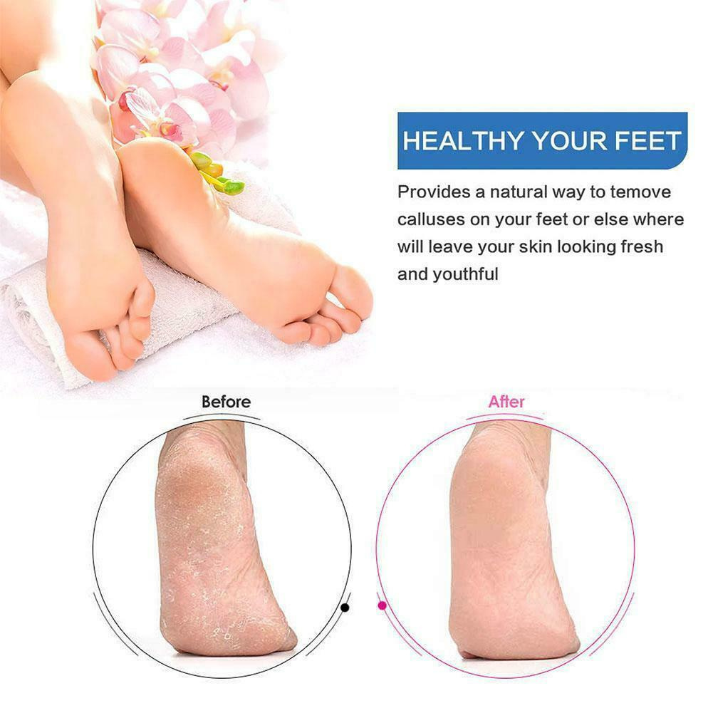 [ 1PC  Foot Care Dead Skin  Remover Tools ] [ Non-Slip Pumice Foot  Stone  ][  Portable PU Scrub  Pedicure Scrubber  ]