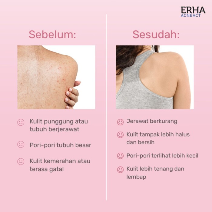 Erha Acneact Acne Body Wash BHA &amp; Mugwort (Sabun Jerawat) - 240ml