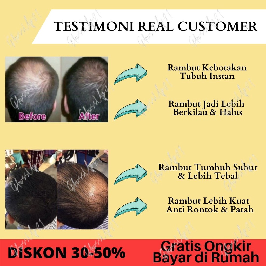 SERUM PENUMBUH RAMBUT BOTAK VENON UNGU SERUM RAMBUT PERAWATAN RAMBUT - HAIR TREATMENT